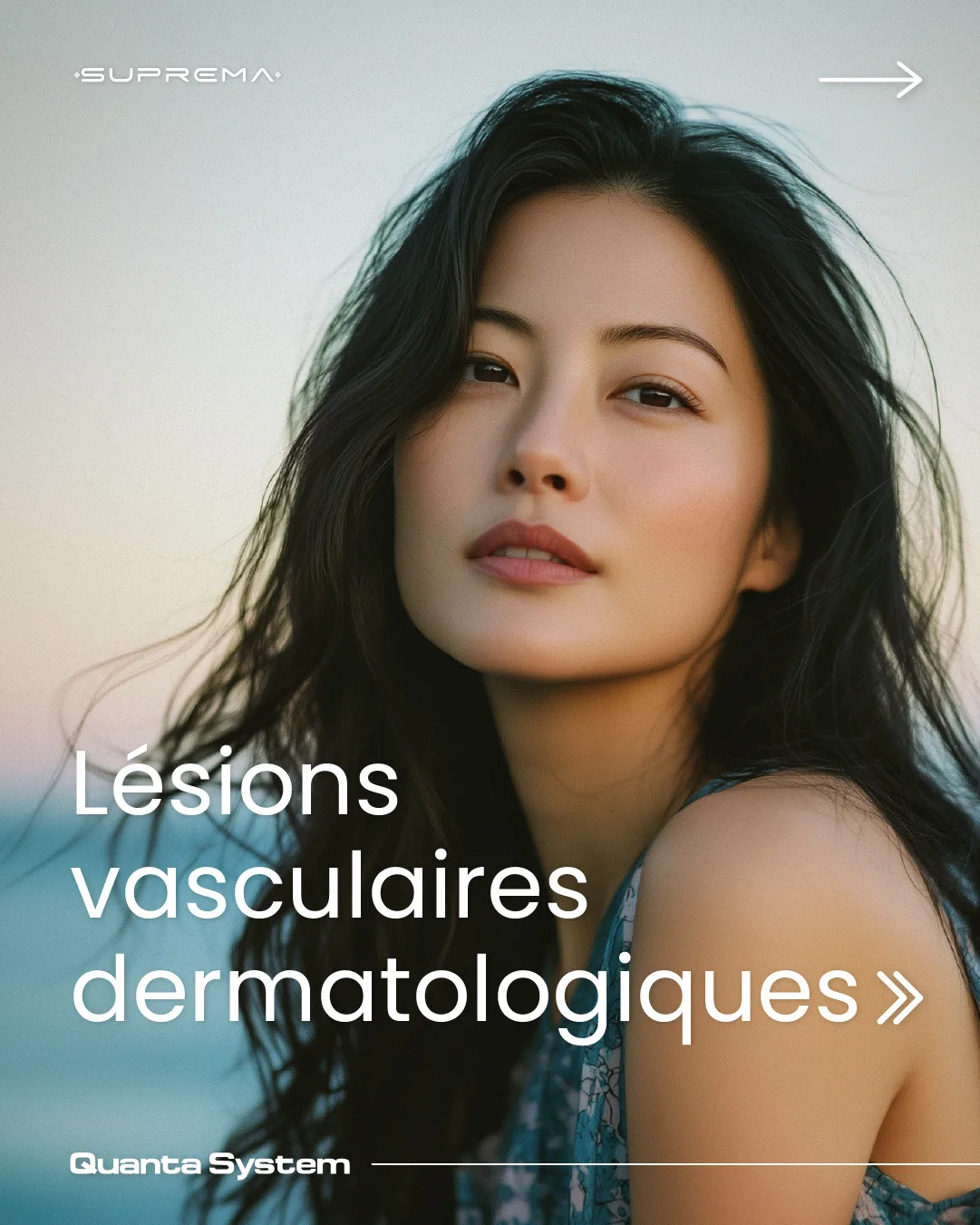 Laser Suprema pour rougeurs et indications vasculaires